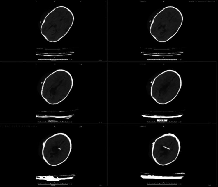 https://cdn.ncbi.nlm.nih.gov/pmc/blobs/360f/11111494/603c15d5e351/381_2024_6344_Fig2_HTML.jpg