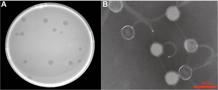 https://cdn.ncbi.nlm.nih.gov/pmc/blobs/3615/11995918/3cd48488a5a6/IDR-18-1807-g0001.jpg