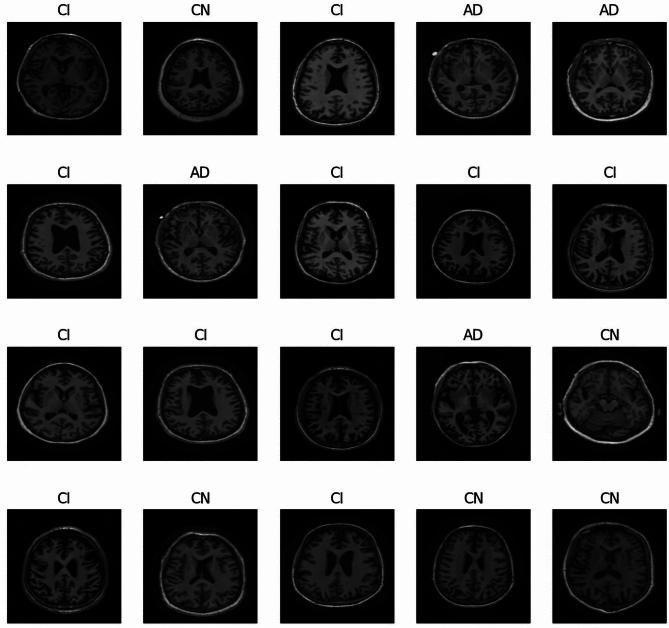 https://cdn.ncbi.nlm.nih.gov/pmc/blobs/3619/12015271/79263cbc7f8a/41598_2025_98476_Fig1_HTML.jpg