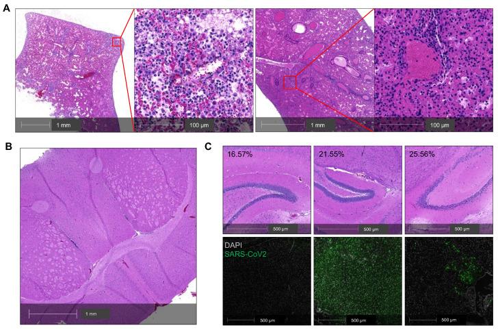 https://cdn.ncbi.nlm.nih.gov/pmc/blobs/361a/8315069/720b02c6d6fa/thnov11p8076g002.jpg