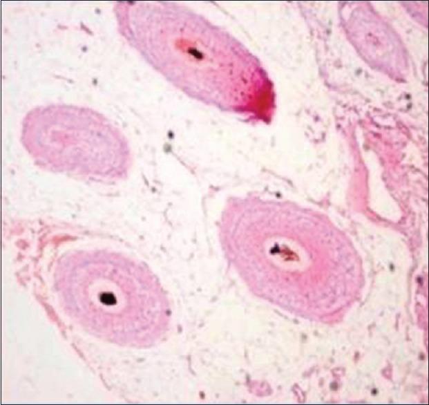 https://cdn.ncbi.nlm.nih.gov/pmc/blobs/361c/5784303/02cd4accecc7/JLP-10-95-g007.jpg