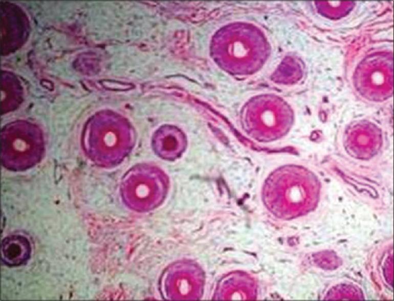 https://cdn.ncbi.nlm.nih.gov/pmc/blobs/361c/5784303/30395c6ec1f9/JLP-10-95-g006.jpg