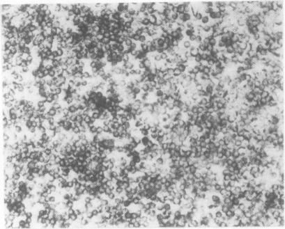 https://cdn.ncbi.nlm.nih.gov/pmc/blobs/361f/497931/8c566a5eb2f9/jclinpath00504-0056-a.jpg