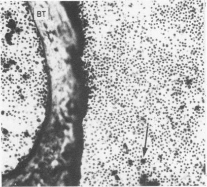 https://cdn.ncbi.nlm.nih.gov/pmc/blobs/361f/497931/bd8c95ef1bc4/jclinpath00504-0055-a.jpg