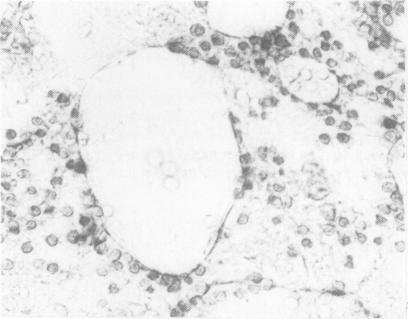 https://cdn.ncbi.nlm.nih.gov/pmc/blobs/361f/497931/f56ab06f637b/jclinpath00504-0056-b.jpg