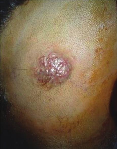 https://cdn.ncbi.nlm.nih.gov/pmc/blobs/3621/3613641/51ff6eba3214/AJNS-7-191-g005.jpg