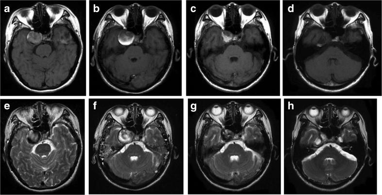 https://cdn.ncbi.nlm.nih.gov/pmc/blobs/3621/4904025/fce88ae5a92d/10143_2016_721_Fig5_HTML.jpg
