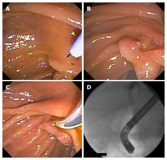 https://cdn.ncbi.nlm.nih.gov/pmc/blobs/3621/5922998/545136d29597/WJG-24-1803-g002.jpg
