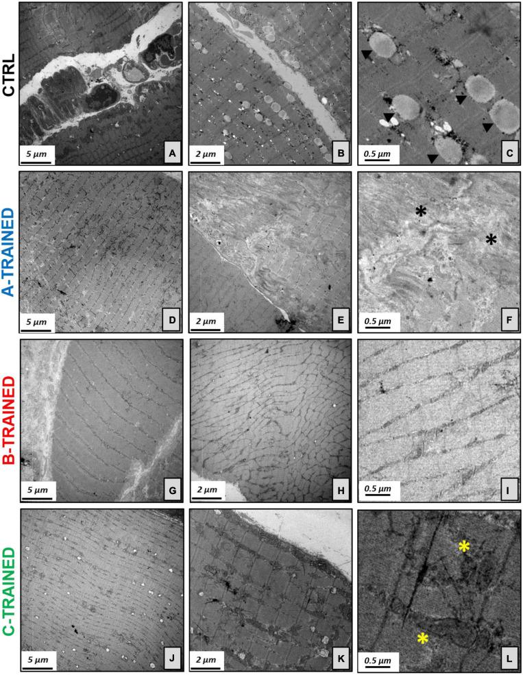 https://cdn.ncbi.nlm.nih.gov/pmc/blobs/3622/8226218/3d2f97bdbf78/fphys-12-678449-g003.jpg