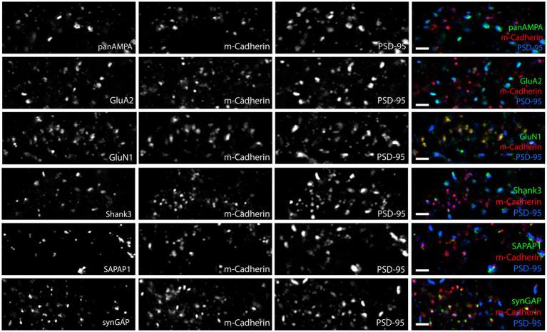 https://cdn.ncbi.nlm.nih.gov/pmc/blobs/3626/11111907/7705d6c04a0e/fnmol-17-1381534-g010.jpg