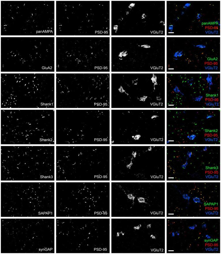 https://cdn.ncbi.nlm.nih.gov/pmc/blobs/3626/11111907/7ce27ffc4117/fnmol-17-1381534-g005.jpg