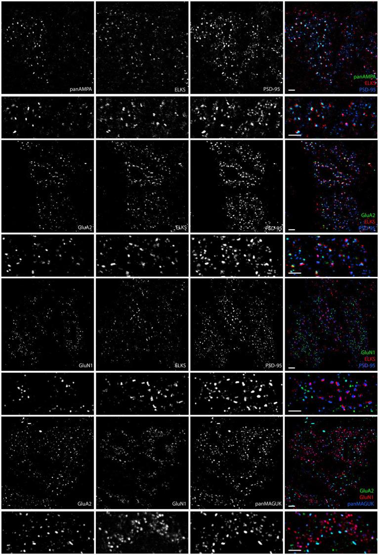https://cdn.ncbi.nlm.nih.gov/pmc/blobs/3626/11111907/aafd79ef9156/fnmol-17-1381534-g007.jpg
