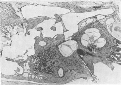 https://cdn.ncbi.nlm.nih.gov/pmc/blobs/362e/2500717/0d91f0f4985d/postmedj00536-0021-c.jpg