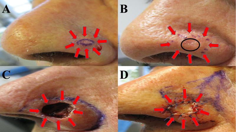 https://cdn.ncbi.nlm.nih.gov/pmc/blobs/362e/7883528/4ea70d52b157/cureus-0013-00000012721-i01.jpg