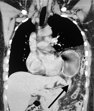 https://cdn.ncbi.nlm.nih.gov/pmc/blobs/3633/7593495/59efb4bb5863/EMP2-1-1121-g002.jpg
