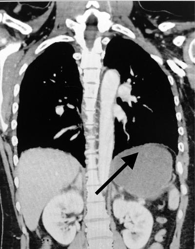 https://cdn.ncbi.nlm.nih.gov/pmc/blobs/3633/7593495/df30f42ed737/EMP2-1-1121-g001.jpg