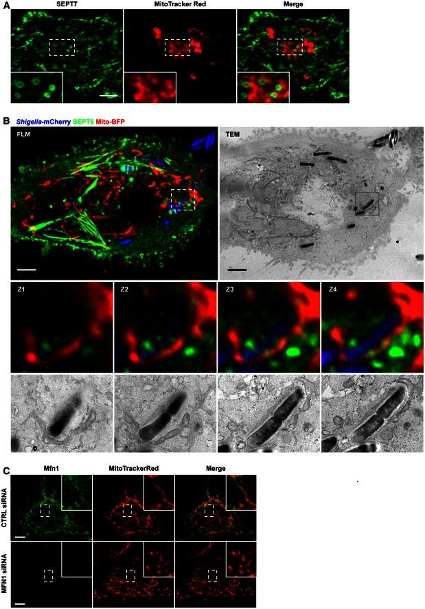 https://cdn.ncbi.nlm.nih.gov/pmc/blobs/3636/4931556/419e68a67693/EMBR-17-1029-g007.jpg
