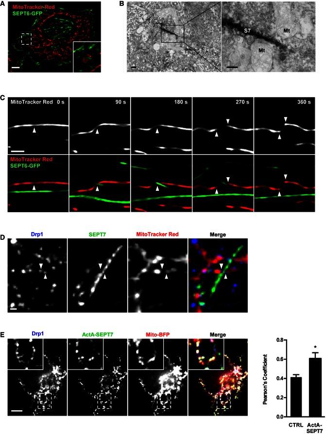 https://cdn.ncbi.nlm.nih.gov/pmc/blobs/3636/4931556/4a91f3b4d745/EMBR-17-1029-g008.jpg