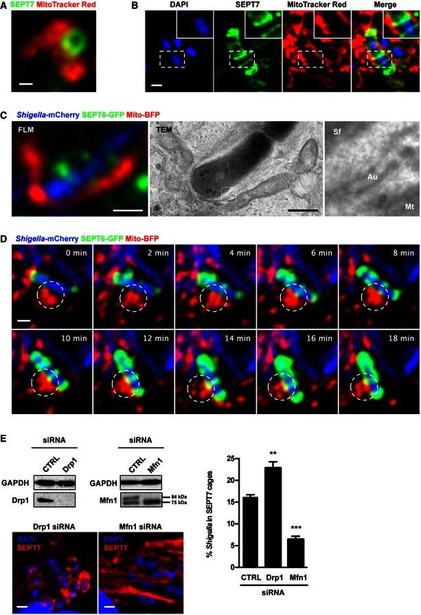 https://cdn.ncbi.nlm.nih.gov/pmc/blobs/3636/4931556/63e99d527b6b/EMBR-17-1029-g006.jpg