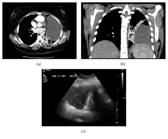 https://cdn.ncbi.nlm.nih.gov/pmc/blobs/3637/6556350/60a9f4fb4a48/CRIRA2019-1301845.001.jpg