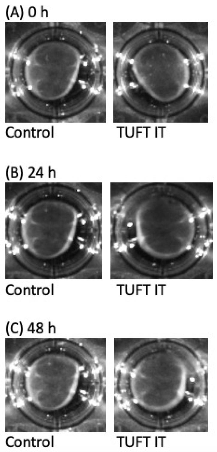 https://cdn.ncbi.nlm.nih.gov/pmc/blobs/363c/10298343/1e50a8e977ab/gels-09-00504-g003.jpg