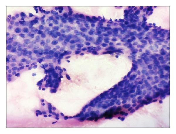https://cdn.ncbi.nlm.nih.gov/pmc/blobs/363f/3972913/16df274d094a/ISRN.ONCOLOGY2014-252103.001.jpg