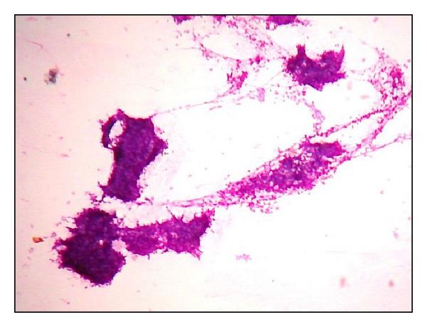 https://cdn.ncbi.nlm.nih.gov/pmc/blobs/363f/3972913/25aef6cb4c77/ISRN.ONCOLOGY2014-252103.003.jpg