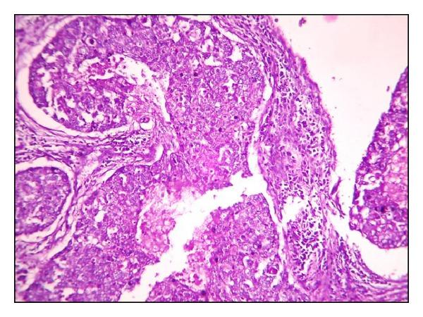https://cdn.ncbi.nlm.nih.gov/pmc/blobs/363f/3972913/3749cd307c37/ISRN.ONCOLOGY2014-252103.014.jpg