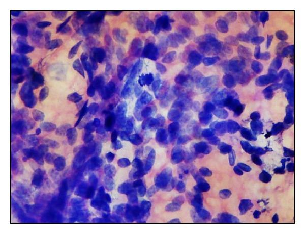 https://cdn.ncbi.nlm.nih.gov/pmc/blobs/363f/3972913/5410c6dd3bbe/ISRN.ONCOLOGY2014-252103.011.jpg