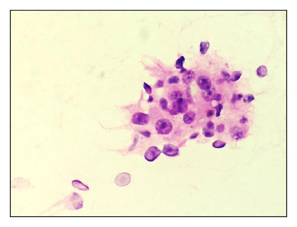 https://cdn.ncbi.nlm.nih.gov/pmc/blobs/363f/3972913/8f0c8f0513f1/ISRN.ONCOLOGY2014-252103.009.jpg