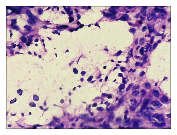 https://cdn.ncbi.nlm.nih.gov/pmc/blobs/363f/3972913/c5a9a03582bc/ISRN.ONCOLOGY2014-252103.006.jpg