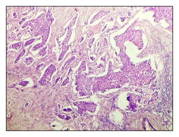 https://cdn.ncbi.nlm.nih.gov/pmc/blobs/363f/3972913/d52265d390c1/ISRN.ONCOLOGY2014-252103.013.jpg