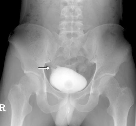 https://cdn.ncbi.nlm.nih.gov/pmc/blobs/3643/2852808/ff4822318003/ymj-51-463-g002.jpg