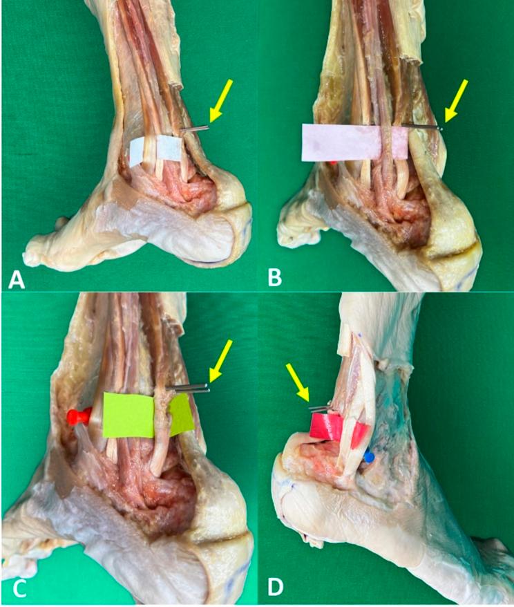 https://cdn.ncbi.nlm.nih.gov/pmc/blobs/364e/11531167/61c91b5c81df/13018_2024_5155_Fig2_HTML.jpg