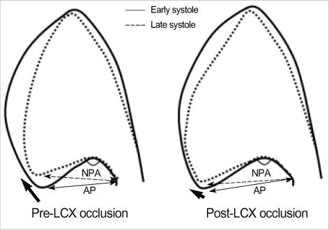 https://cdn.ncbi.nlm.nih.gov/pmc/blobs/3650/2733994/ecde51da1cfc/jkms-21-217-g006.jpg