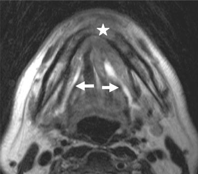 https://cdn.ncbi.nlm.nih.gov/pmc/blobs/3650/2842176/33c9c3d0c17e/ci10000805.jpg