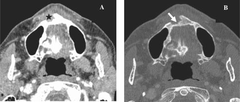 https://cdn.ncbi.nlm.nih.gov/pmc/blobs/3650/2842176/89deffb512f9/ci10000808.jpg