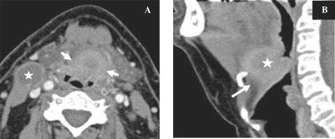 https://cdn.ncbi.nlm.nih.gov/pmc/blobs/3650/2842176/c8514249e80e/ci10000809.jpg