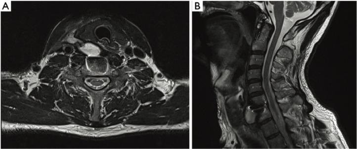 https://cdn.ncbi.nlm.nih.gov/pmc/blobs/3651/10999484/f6b4c05859a8/gr2.jpg