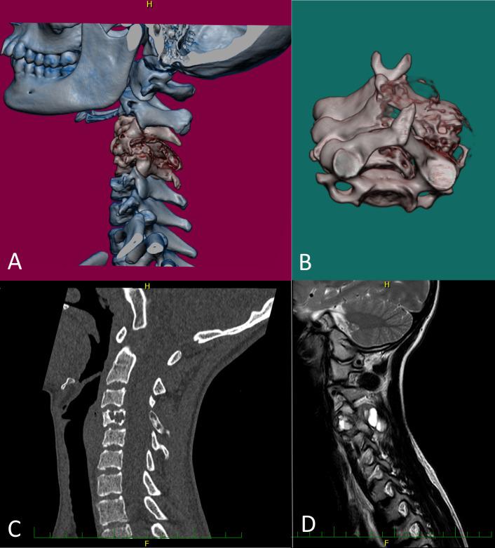 https://cdn.ncbi.nlm.nih.gov/pmc/blobs/365b/12171395/6762108bee38/jcp-78-6-g002.jpg