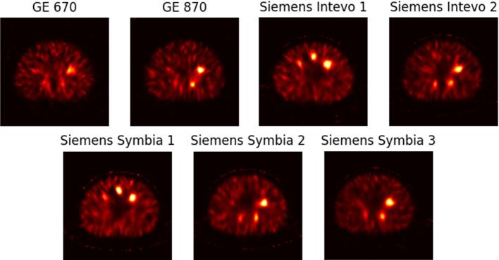 https://cdn.ncbi.nlm.nih.gov/pmc/blobs/365c/11920561/ae274927a5b4/40658_2025_733_Fig2_HTML.jpg