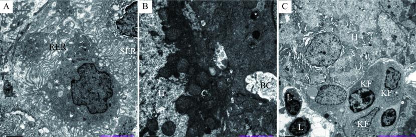 https://cdn.ncbi.nlm.nih.gov/pmc/blobs/365e/9179110/310856b499e9/jbr-36-3-215-3.jpg