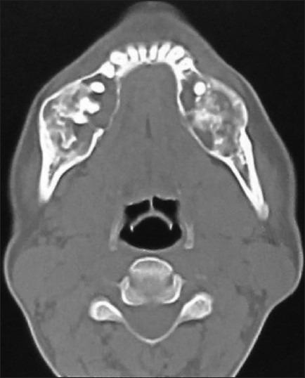 https://cdn.ncbi.nlm.nih.gov/pmc/blobs/3662/3830241/d376e1770306/JOMFP-17-274-g005.jpg