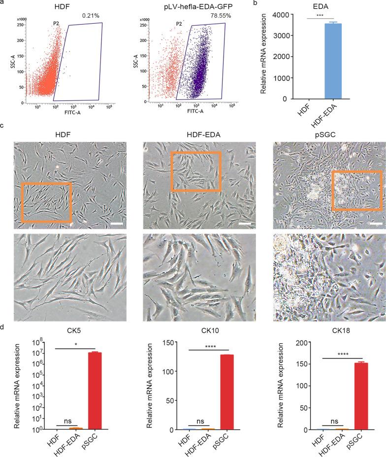 https://cdn.ncbi.nlm.nih.gov/pmc/blobs/366b/8962256/f99affba7927/40779_2022_372_Fig1_HTML.jpg