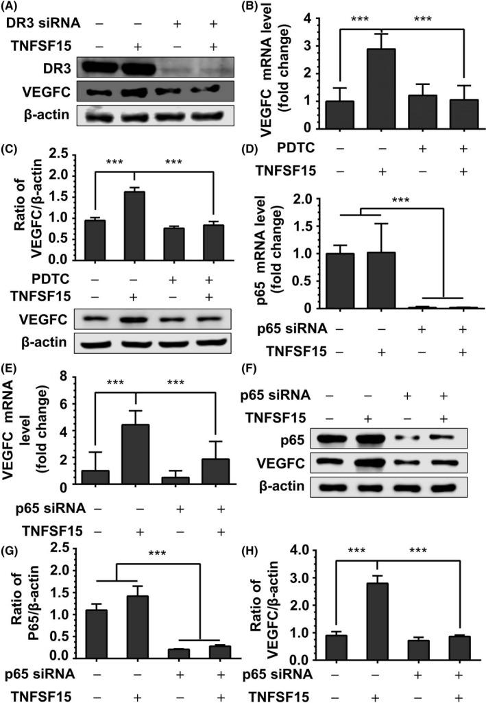 https://cdn.ncbi.nlm.nih.gov/pmc/blobs/366f/6113425/219ff74cf952/CAS-109-2469-g005.jpg