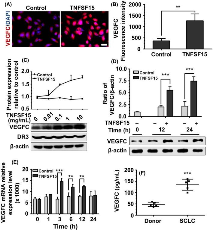 https://cdn.ncbi.nlm.nih.gov/pmc/blobs/366f/6113425/9189f740a830/CAS-109-2469-g004.jpg