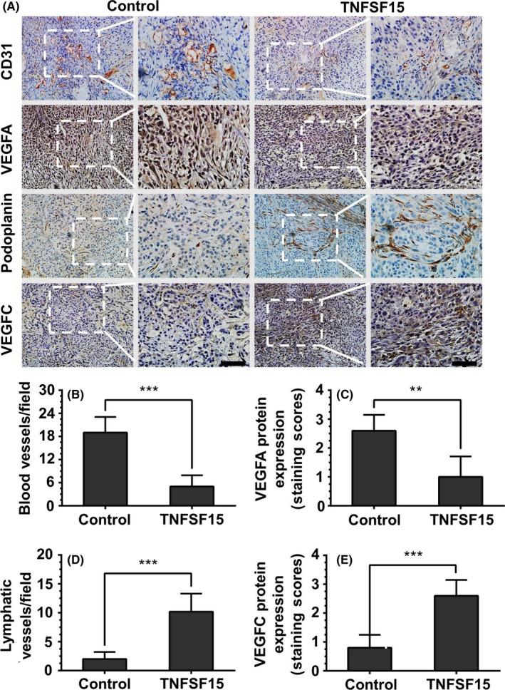 https://cdn.ncbi.nlm.nih.gov/pmc/blobs/366f/6113425/a2a4b0e6d3c4/CAS-109-2469-g002.jpg