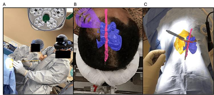 https://cdn.ncbi.nlm.nih.gov/pmc/blobs/3674/11317059/23b397a7d6e0/cureus-0016-00000064403-i02.jpg