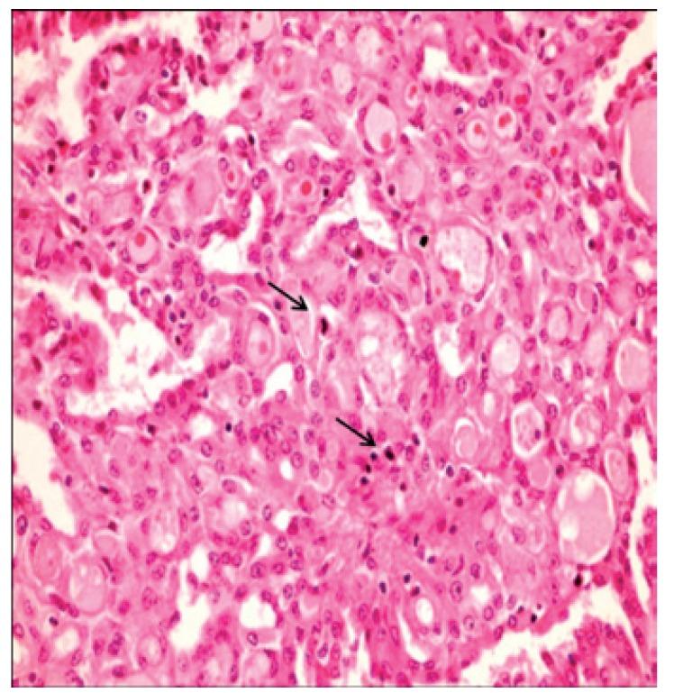 https://cdn.ncbi.nlm.nih.gov/pmc/blobs/3675/4320417/0a0ca6193464/medoral-20-e23-g005.jpg