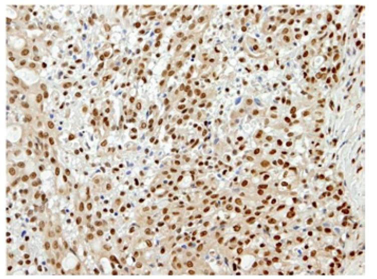 https://cdn.ncbi.nlm.nih.gov/pmc/blobs/3675/4320417/0d26013dc7e3/medoral-20-e23-g007.jpg